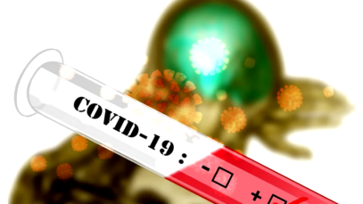 Covid-19