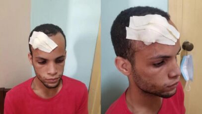 Activista cubano se autolesiona