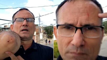 jose-daniel-ferrer-heridas-758×411