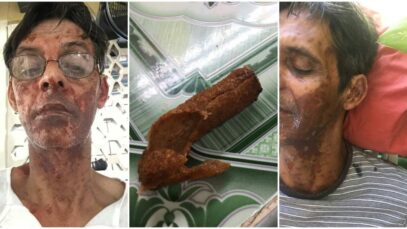 croquetas de venta estatal