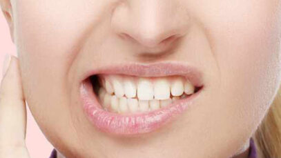 sensibilidad dental
