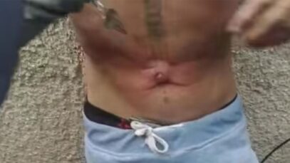 cubano-recibe-disparo-abdomen-camaguey